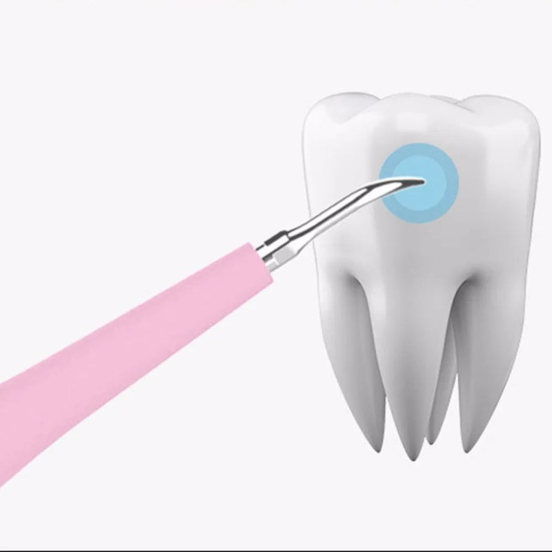 Removedor de Tártaro e Sujeiras - Dental