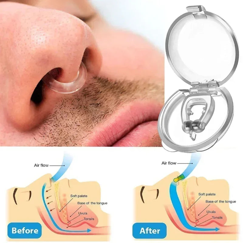 Silicone Magnético Anti-Ronco - Zero Ronco (Compre 2 Leve 4)