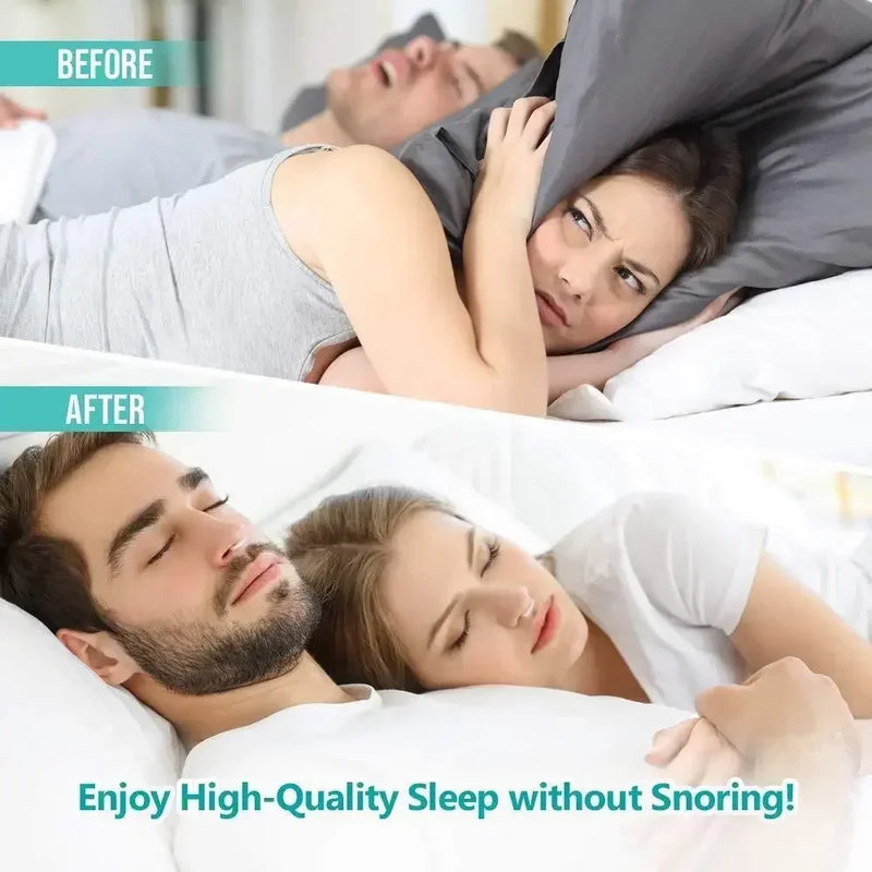 Silicone Magnético Anti-Ronco - Zero Ronco (Compre 2 Leve 4)